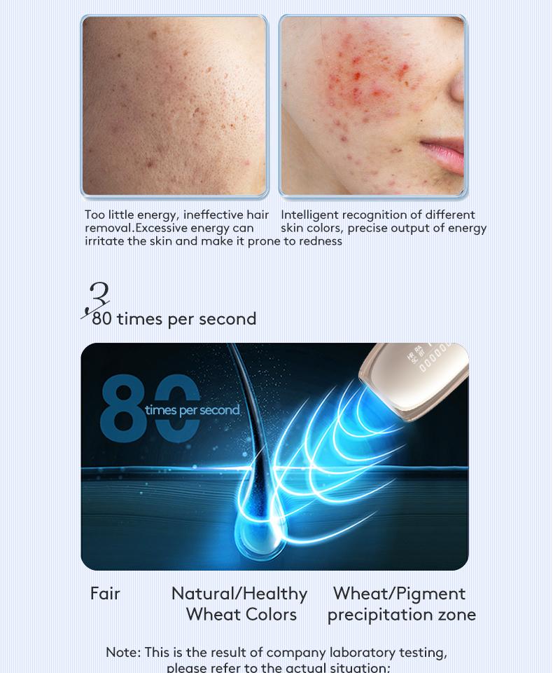 IPL Laser Hair Removal Device with Sapphire Ice-Cooling Technology for Women & Men, Painless & Long-Lasting Hair Remover for Full Body Use at Home, Safe on Face, Bikini Line, Armpits