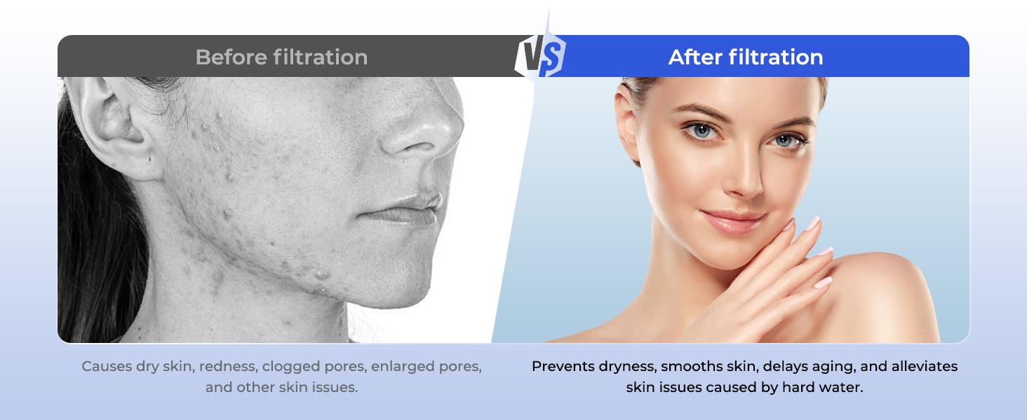 4 Pack Shower Head Compatible with Feellso Shower Head, Hard Softener Cartridge, Removes Chlorine and metals to Improve Skin & Hair