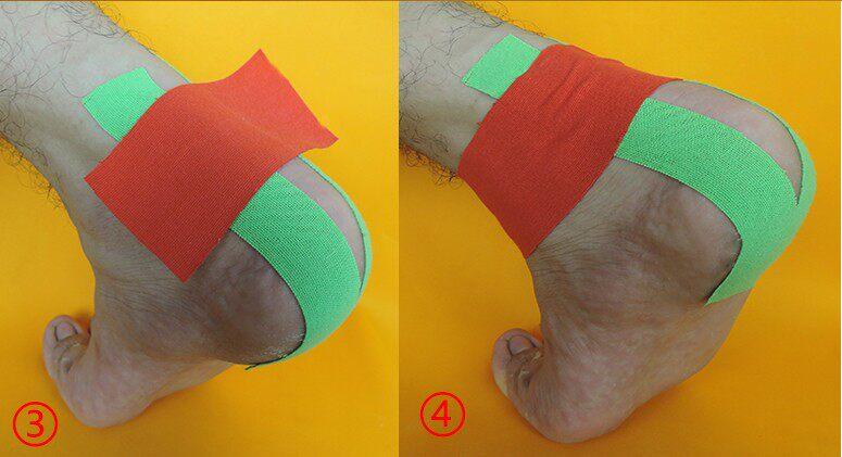 Muscle patch Athlete special strain bandage Achilles tendon muscle patch Self-adhesive tape Internal effect patch Basketball badminton