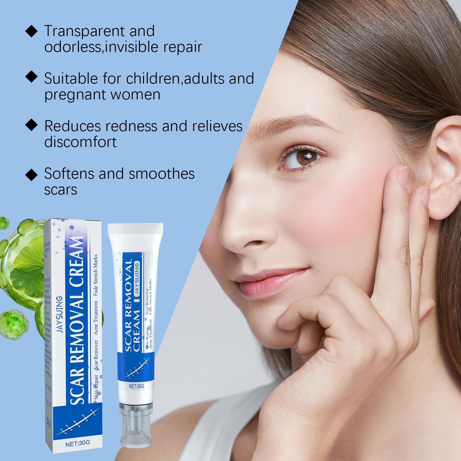 Advanced Silicone Scar Cream - Improves Appearance of Scars, Smooths & Hydrates Skin, Gentle Formula for Old & New Scars 30g