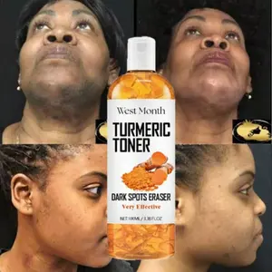Turmeric Toner 100ML 3.38FL OZ for Dark Spots Fading Smooth Tightening Brightening Even Skin Tone Deep Hydration Facial Toner