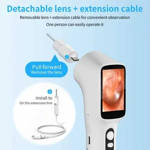 Smart Detector with Screen, 480p HD Ear Camera, 5 Replacement Ear Spoons, Inspects Ears, Nose, Skin, Mouth, Pet Friendly, Christmas Gift