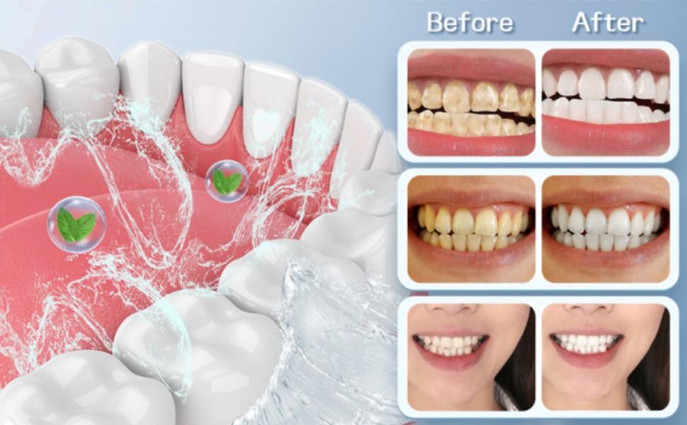 Hydroxyapatite Toothpaste, 2026 New Upgraded Formula 10% Nano-Hydroxyapatite Toothpaste Strengthens Enamel, Fluoride-Free Toothpastes with Gentle on Sensitive Teeth and Freshens Breath(4.23oz, 2Pcs)