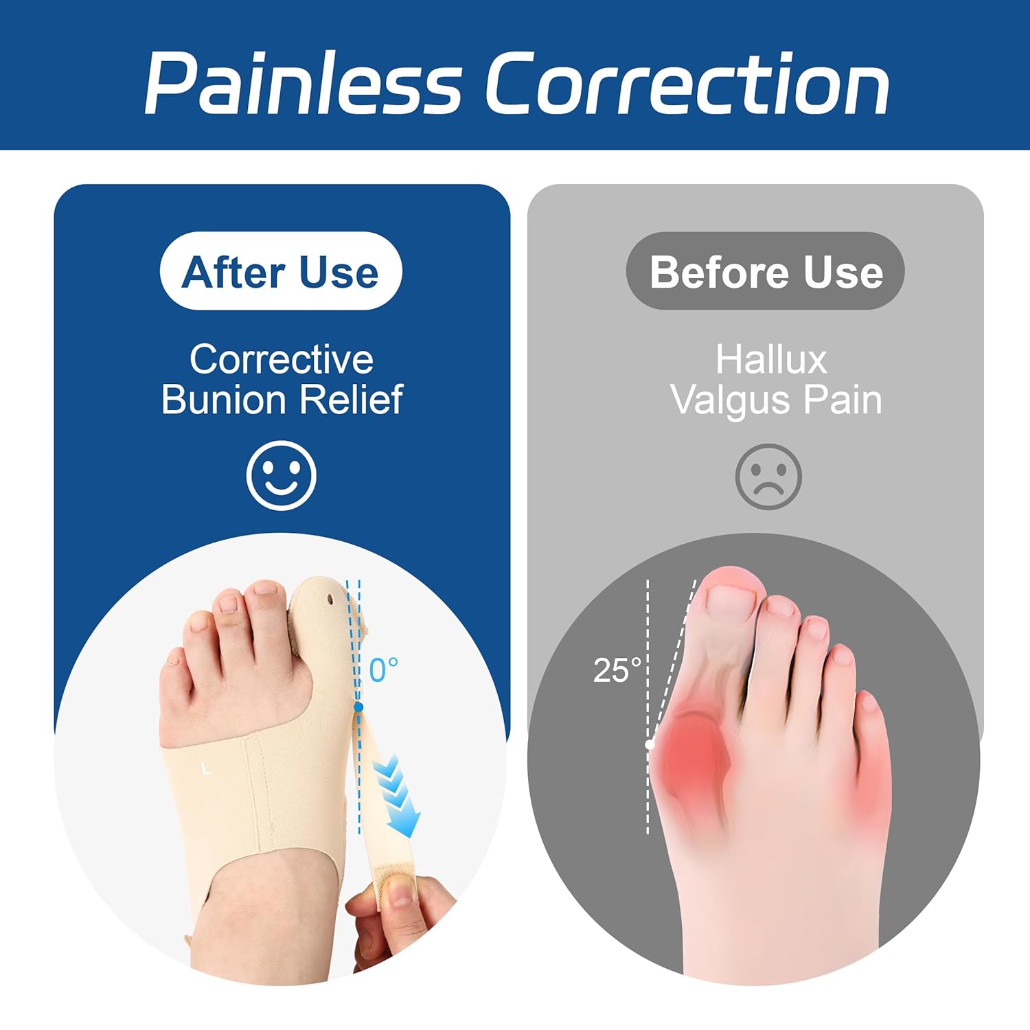 Adjustable Bunion Corrector for Big Toe Alignment, Wear-in-Shoes Pain Relief Brace