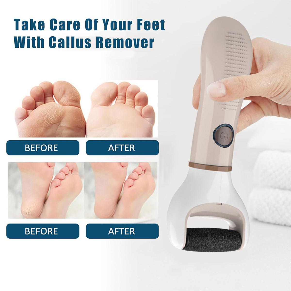 Electric Foot File, 1 Box Portable Foot Callus Remover, Foot Dead Skin Remover, Professional Pedicure Tool for Home & Salon Use, Callus Remover Feet