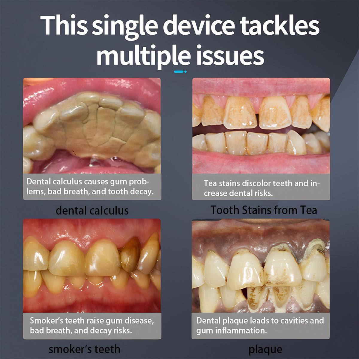 Plaque Remover for Teeth,Tartar Remover for Teeth Cleaning with 3 Replaceable Heads and 5 Adjustable Modes, Rechargeable Teeth Cleaning Plaque Remover for Home