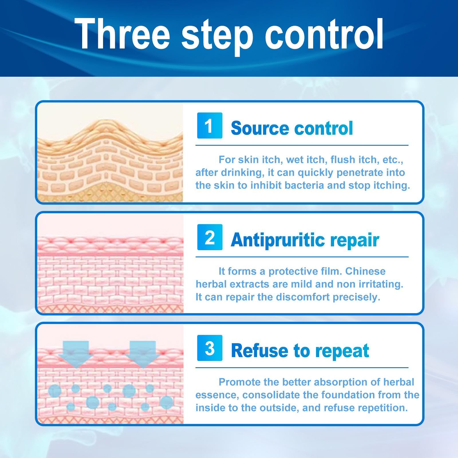 South Moon Urticaria Cream, Topical Ointment For Relieving Pruritus Redness And Repairing Skin