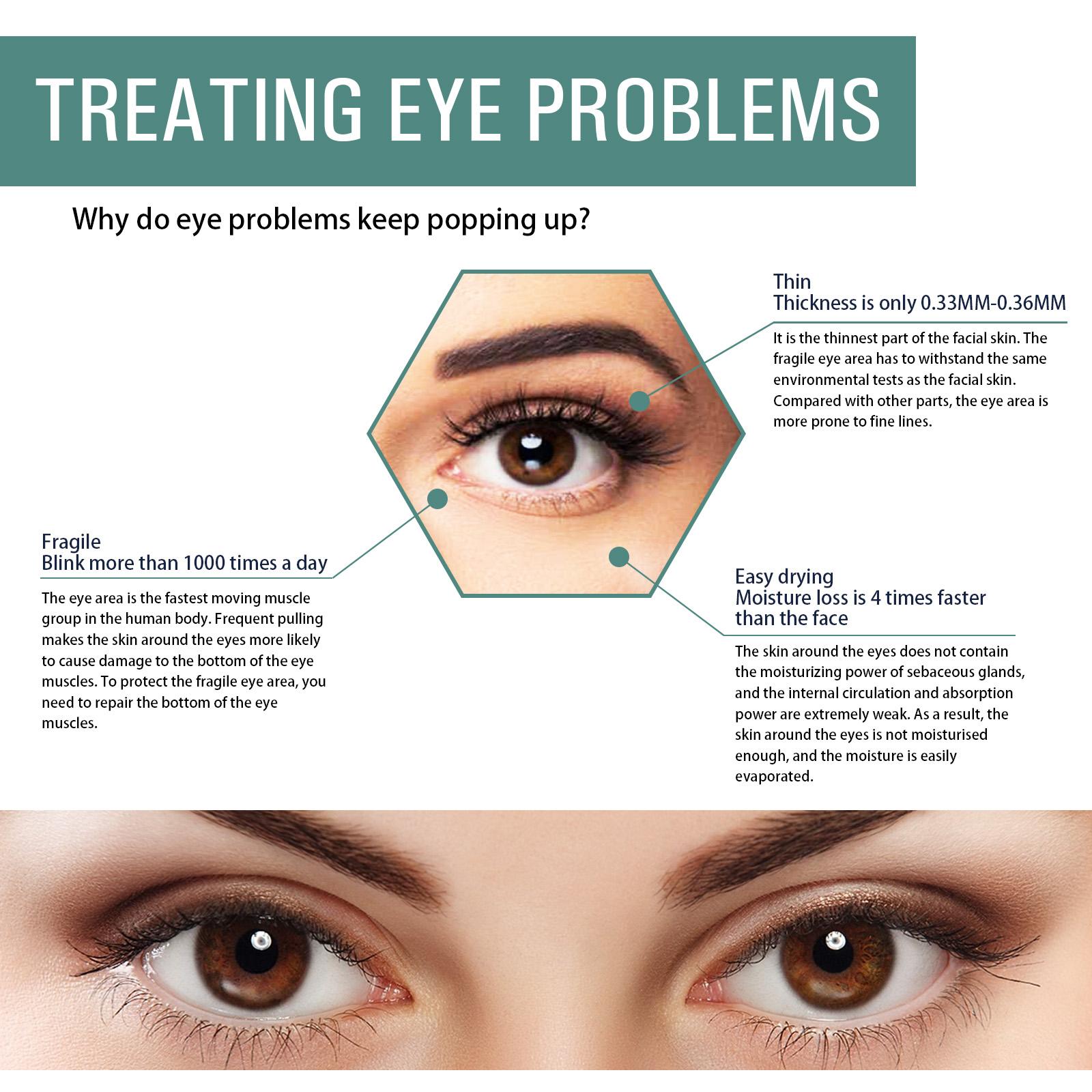 EELHOE Anti-Wrinkle Eye Cream Protects The Skin Around The Eyes And Reduces Dark Spots, Dry Lines And Fine Lines