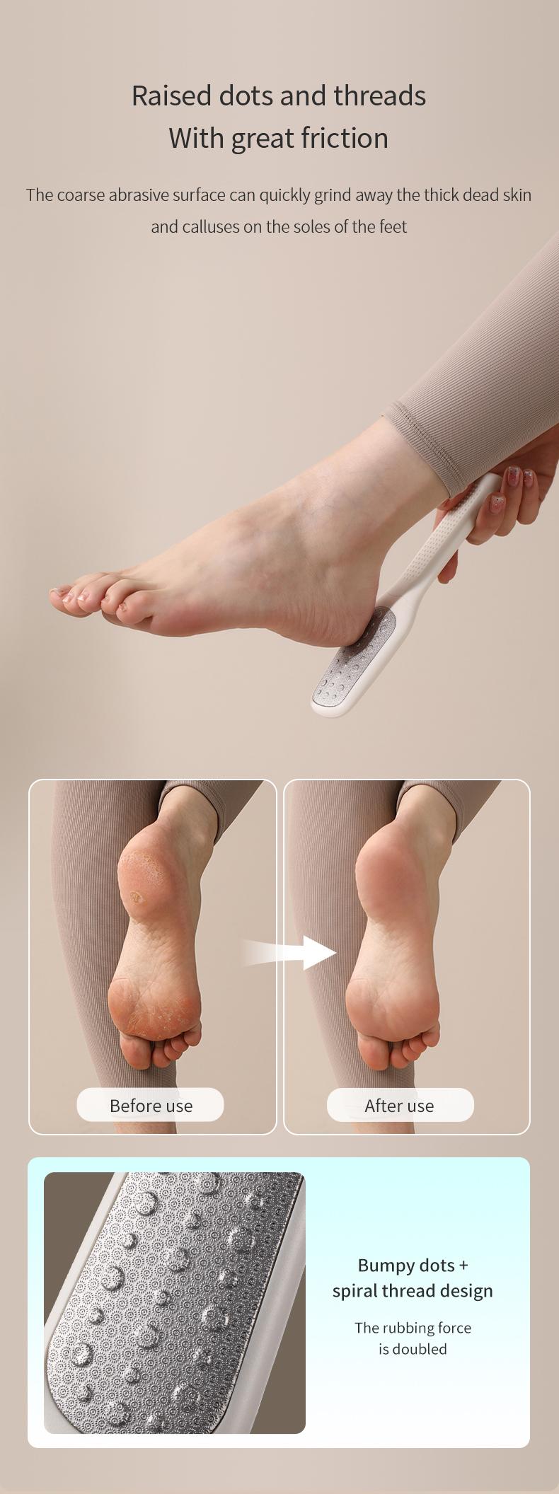 FaSoLa foot grinding tool for removing dead skin and calluses, home-use pedicure stone for scraping the soles and heels, double-sided foot scrubber