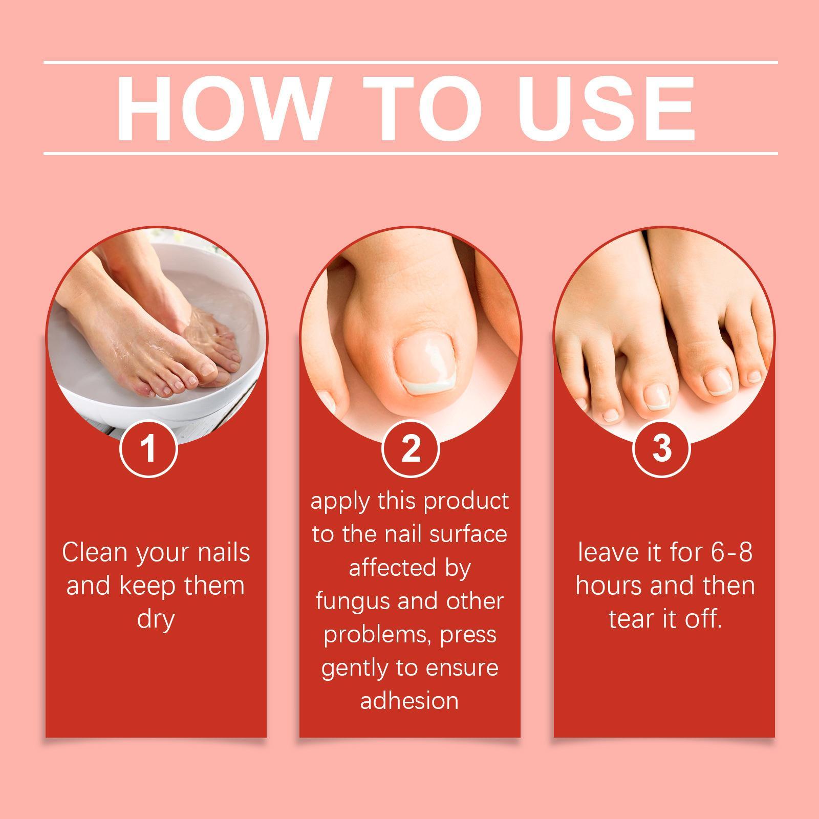 Fungal Nail Patches, 21pcs/box Nail Health Care Patches, Effective Solution for Fungal Nails & Nail Problems, Daily Nail Care Kit