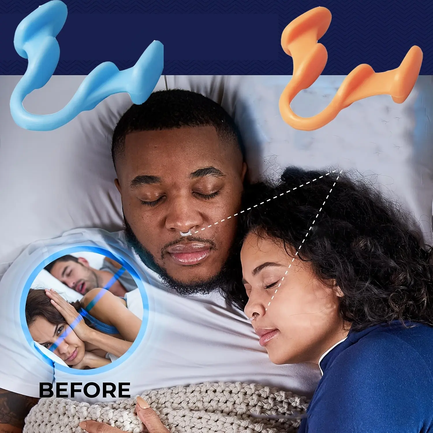 3-Pack Sleep Nasal Dilators, Enhance Oxygen Flow, Improve Sleep Quality, Anti-Snoring Solution, No Power Required, Yiwu Manufactured
