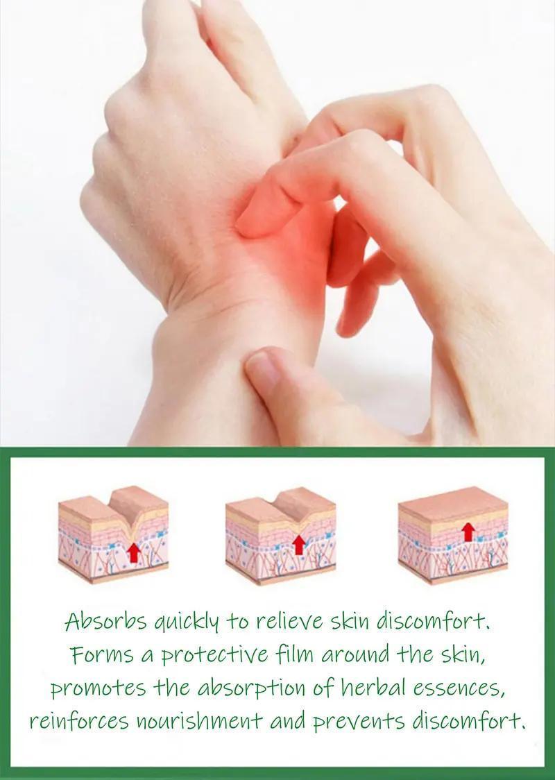 Premium All-Natural Herbal Soothing Cream for Psoriasis, Eczema, Dry & Sensitive Skin Relief | Plant-Based Itch Treatment Balm for Mosquito Bites - 30g