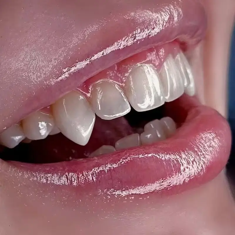 3-Piece Vampire Fang Set with Adhesive Beads, 17mm Plastic Teeth for Costume Parties, Fun Holiday Gift, Carnival Accessory, Cosplay Makeup