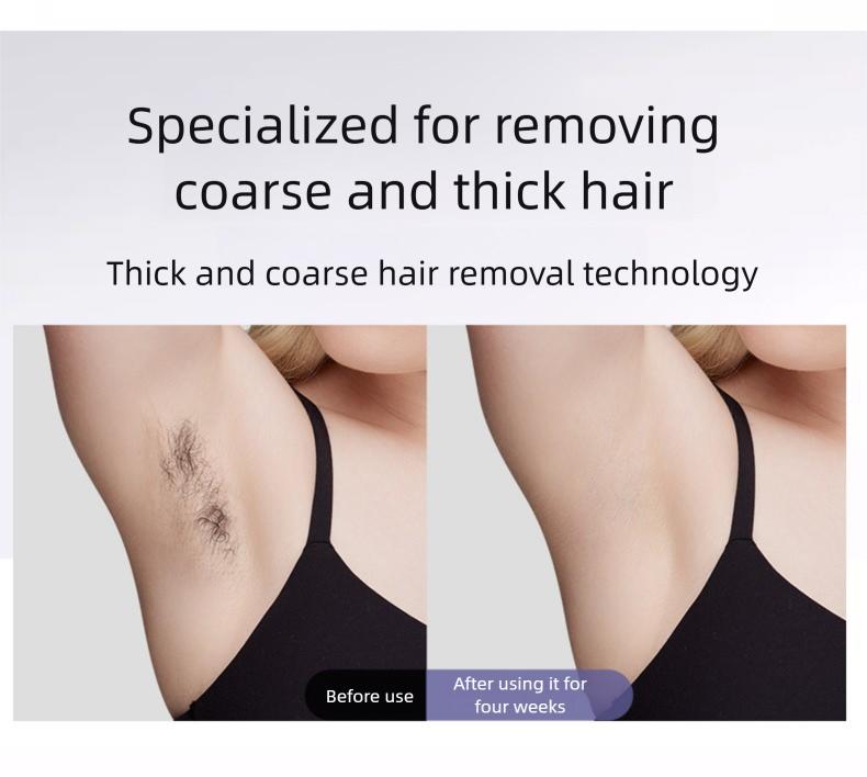 IPL Laser Hair Removal Device with Sapphire Ice-Cooling Technology for Women & Men, Painless & Long-Lasting Hair Remover for Full Body Use at Home, Safe on Face, Bikini Line, Armpits