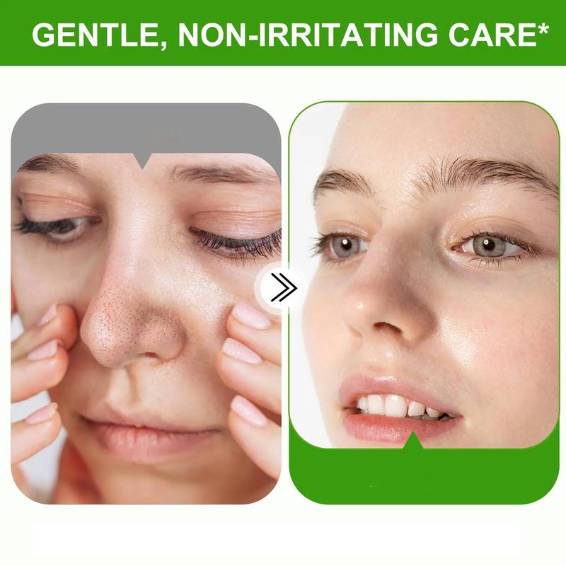 Masaigge Blackhead Nose Mask 30g, Deep Cleansing Peel-Off Mask, Removes Blackheads & Pores, Skin Care Treatment, Made in China, Nose Strips