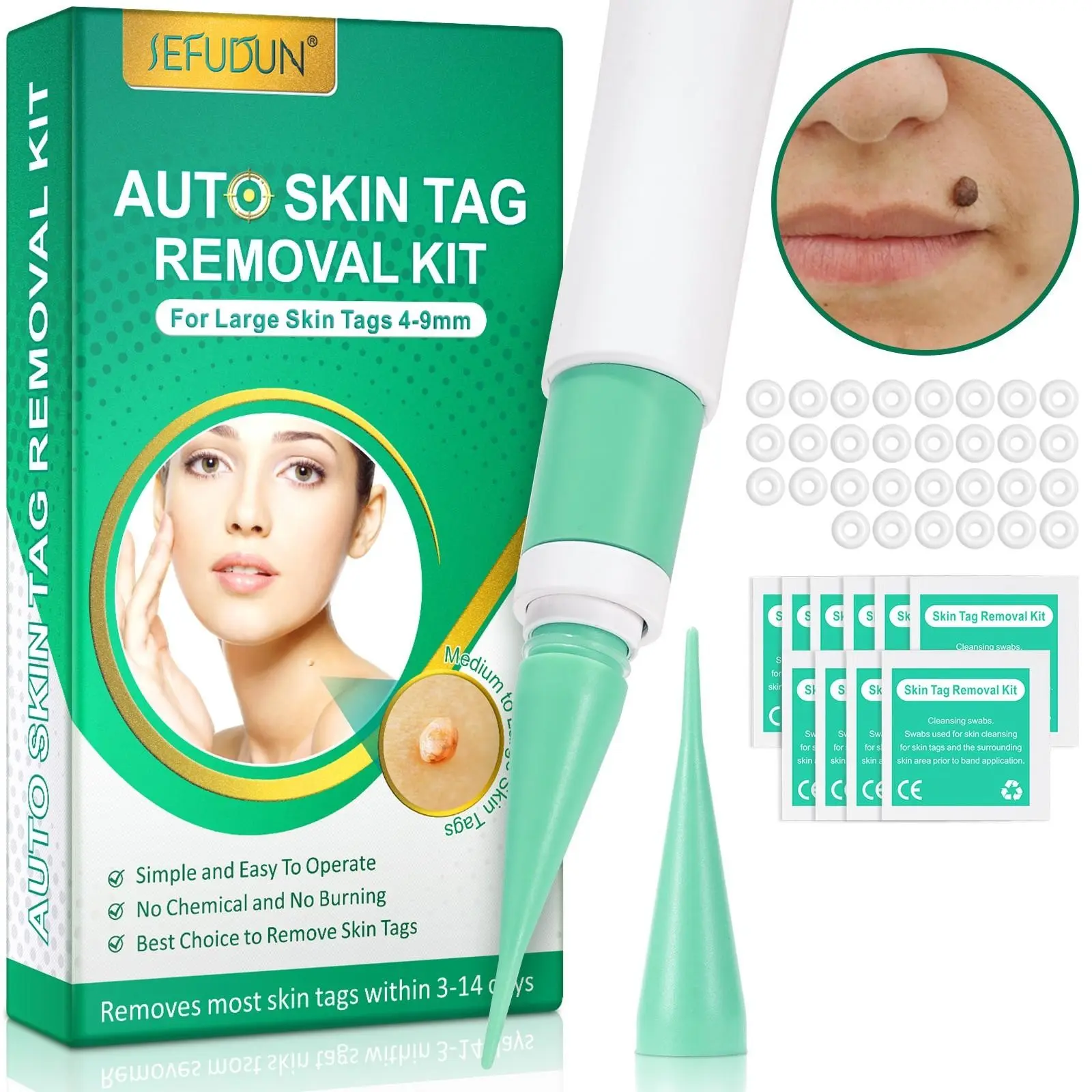 1 set of skin-smoothing tools, designed for large skin tags measuring 4–9 mm; easy and convenient to use, for smooth skin care at home