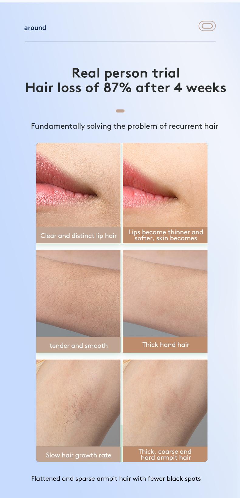 IPL Laser Hair Removal Device with Sapphire Ice-Cooling Technology for Women & Men, Painless & Long-Lasting Hair Remover for Full Body Use at Home, Safe on Face, Bikini Line, Armpits