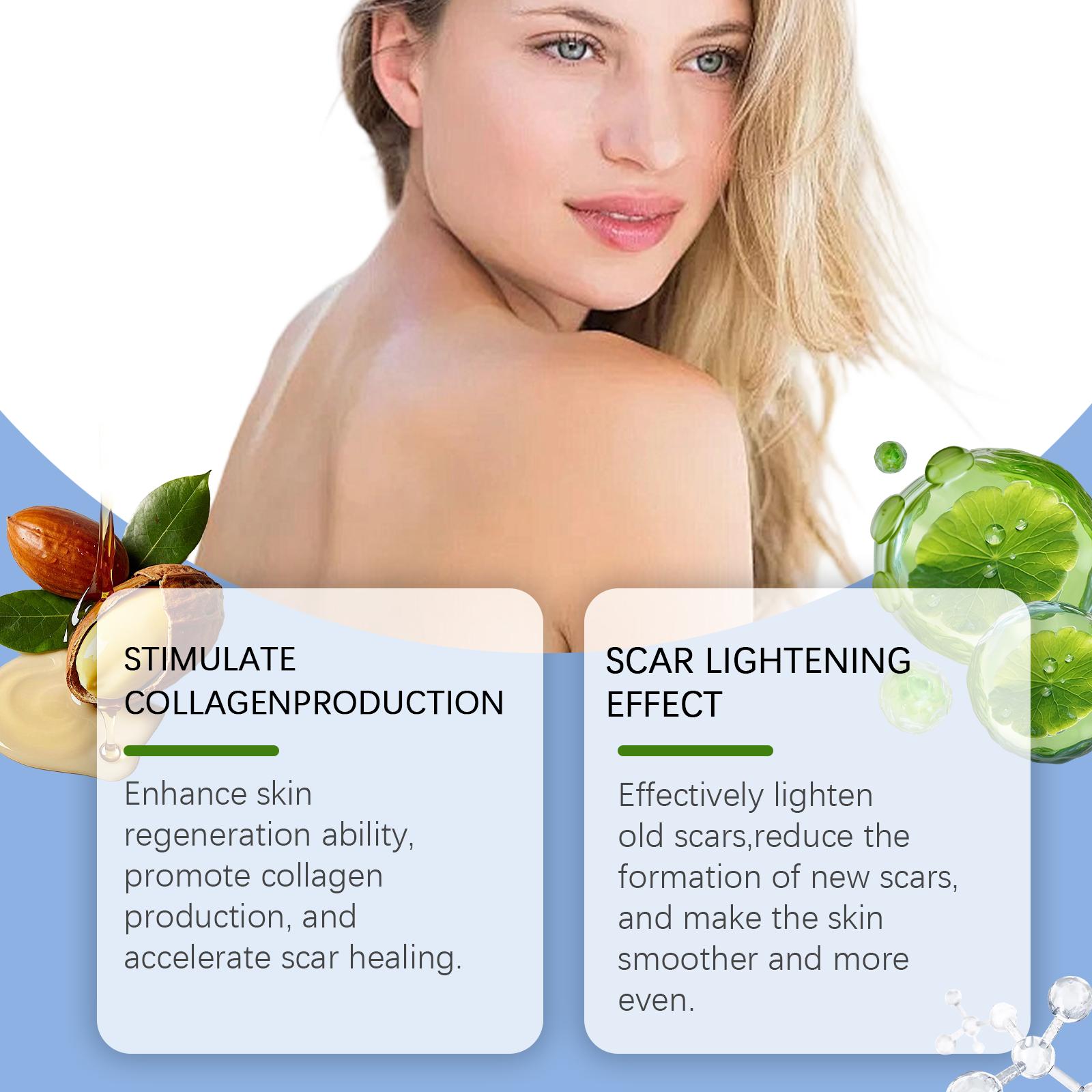 Advanced Silicone Scar Cream - Improves Appearance of Scars, Smooths & Hydrates Skin, Gentle Formula for Old & New Scars 30g