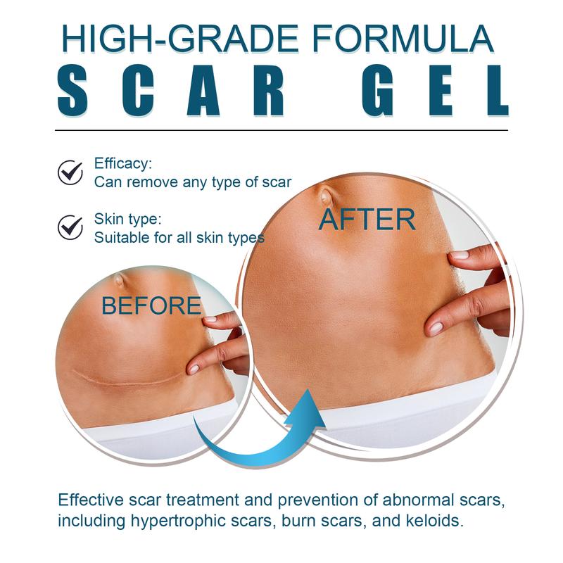 West&Month High-Grade Formula Scar Gel, Scar Repair Surgery Scar Pregnancy Smoothing Skin Care Gel