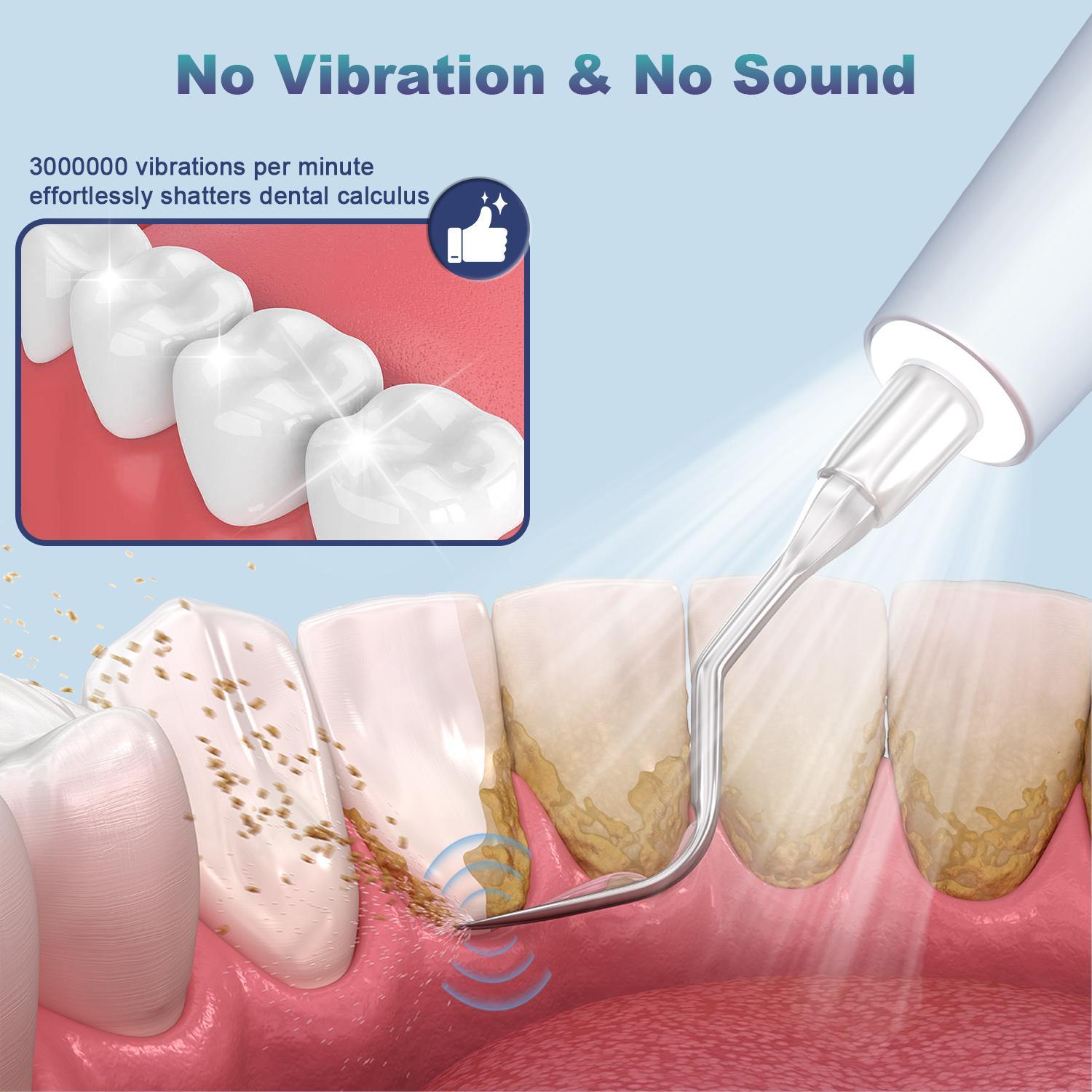 Ultrasonic Dental Plaque Remover for Humans & Pets - Professional Teeth Cleaning Kit for Tartar & Stain Removal, Safe & Gentle Electric Toothbrush for Cats, Dogs and People #SummerVibes Ultrasonic Dental Plaque Remover for Humans & Pets - Professional Teeth Cleaning Kit for Tartar & Stain Removal, Safe & Gentle Electric Toothbrush for Cats, Dogs and People #SummerVibes
