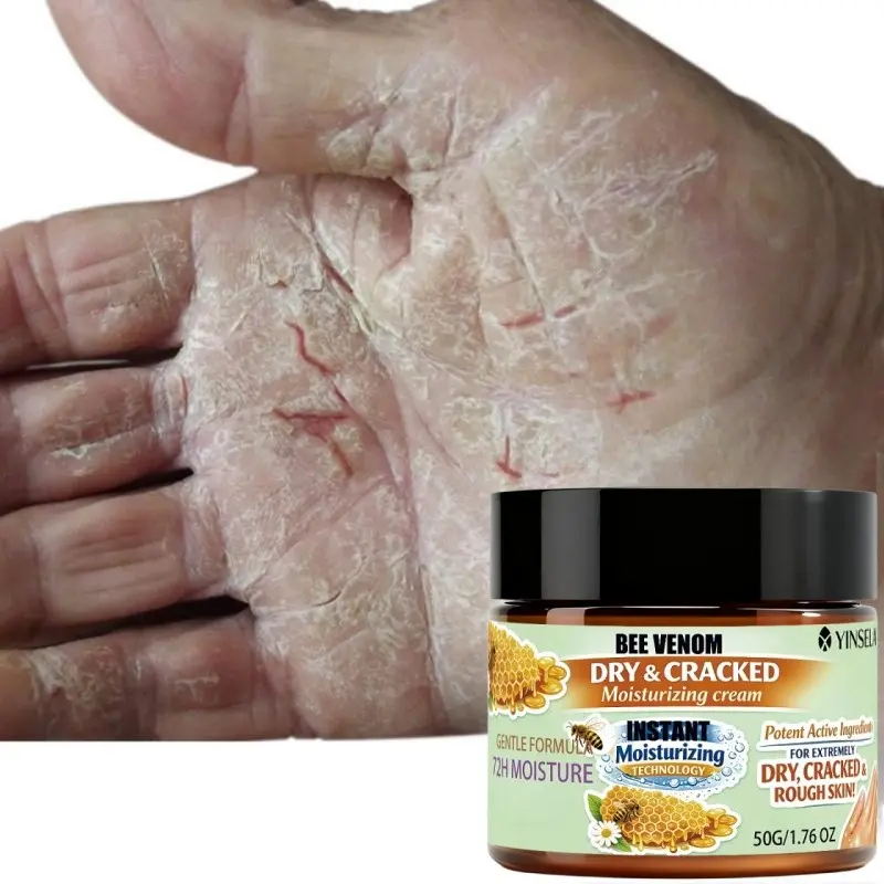 Smooth Moisturizing Cream, 50g Bee Venom Dry Crack Relief, Instant Hydration, Long-Lasting 72hr Moisture, Hand & Foot Care