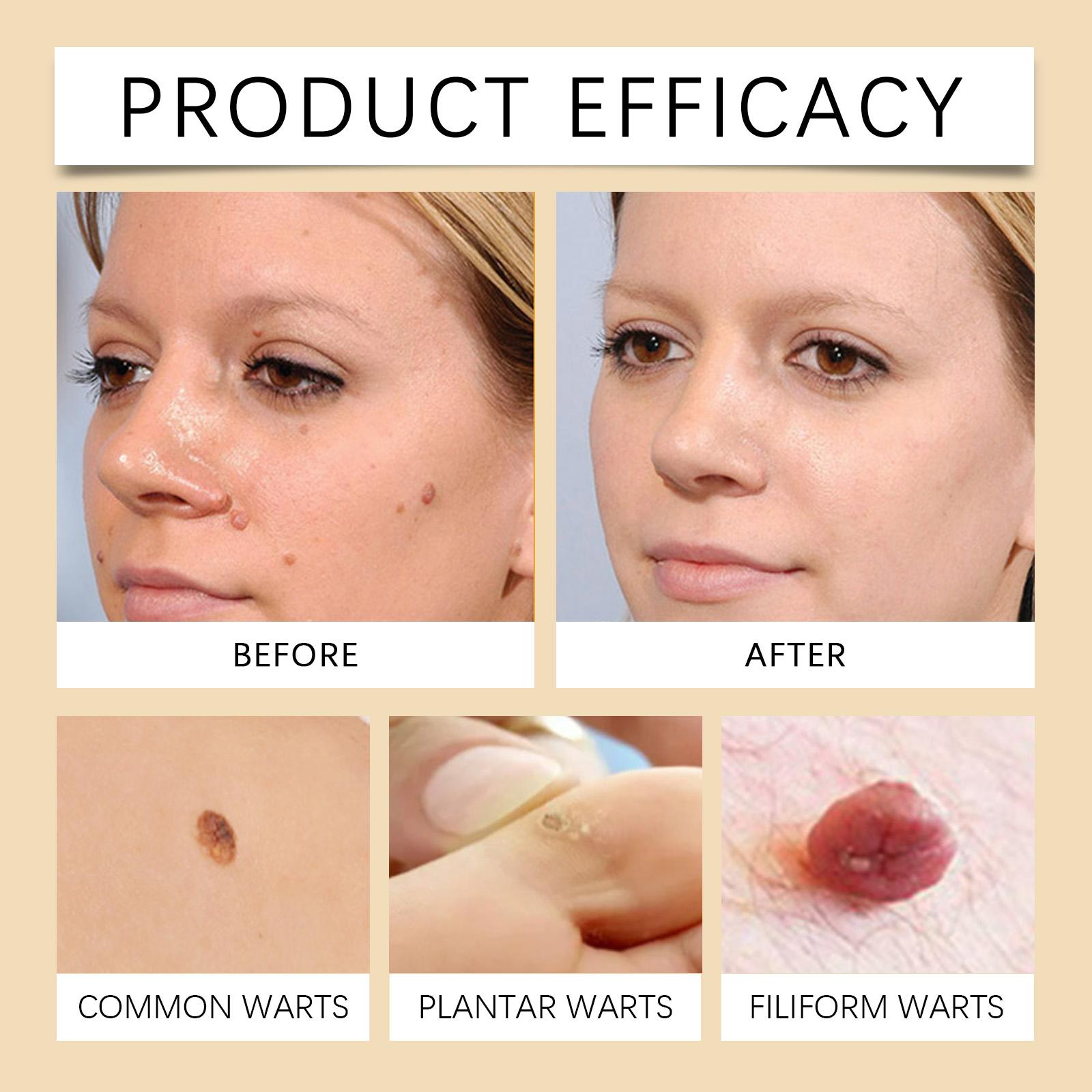 Houkea Skin Repair Cream Gently Cleanses, Moisturizes, Smoothes And Moisturizes Skin Kew Daily Body Care Cream