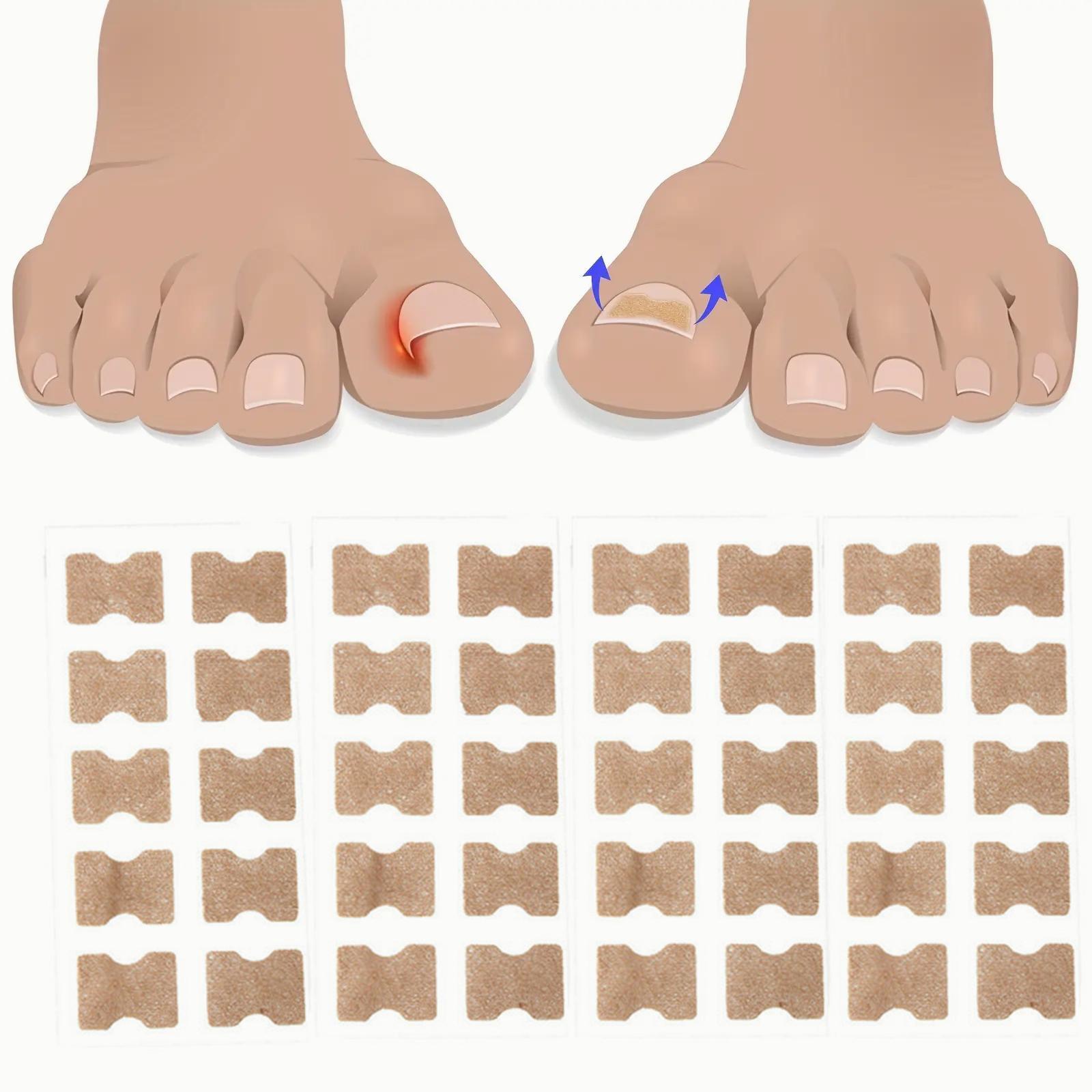 Ingrown Toenail Correction Patch, 30pcs/set Breathable Toe Nail Correction Strip, Professional Pedicure Tool for Home & Beauty Salon Use