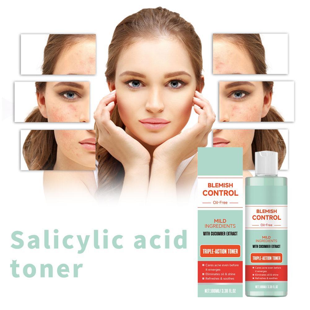 Acne-fighting, Pore-cleansing Salicylic Acid Toner Nourishes The Skin Repairs The Skin Barrier And Contains Gentle Ingredients