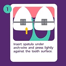 Orthodontic Flossers for Braces, 30 Count (Pack of 2), Ortho Picks for Adults & Kids, Fits Under Arch Wire, Non-Damaging, Encourage Flossing Habits