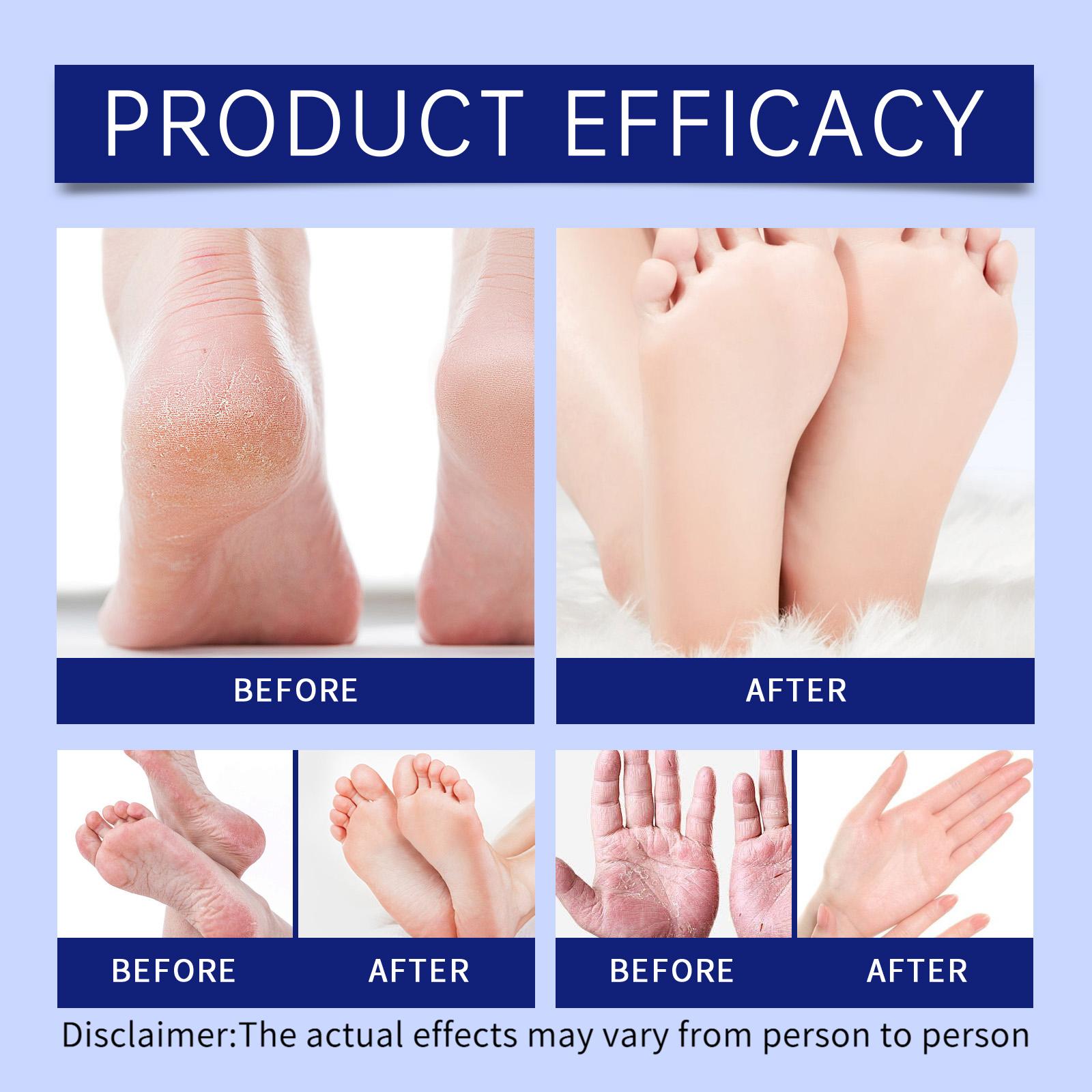 Moisturizing Protective Foot Cream HK-A07-0006-01 100g Daily Care Hydrating Nourishing for Dry Feet Urea Glycerin Mineral Oil - Moisturize