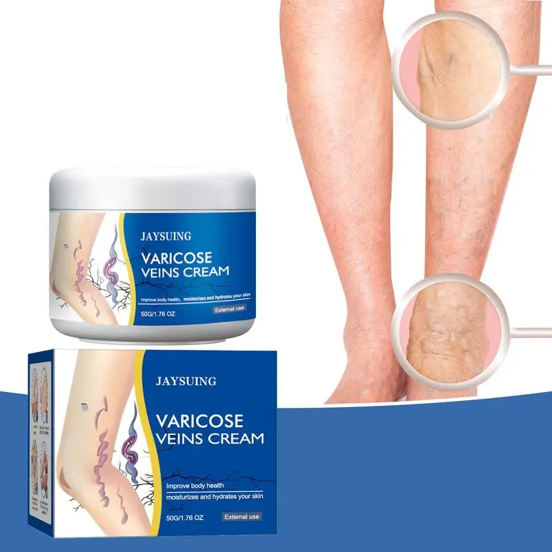 JAYSUING Bee Venom Varicose Veins Relief Solid Balm | Alcohol-Free Leg Care Moisturizer for Dry Skin 50g leg massage