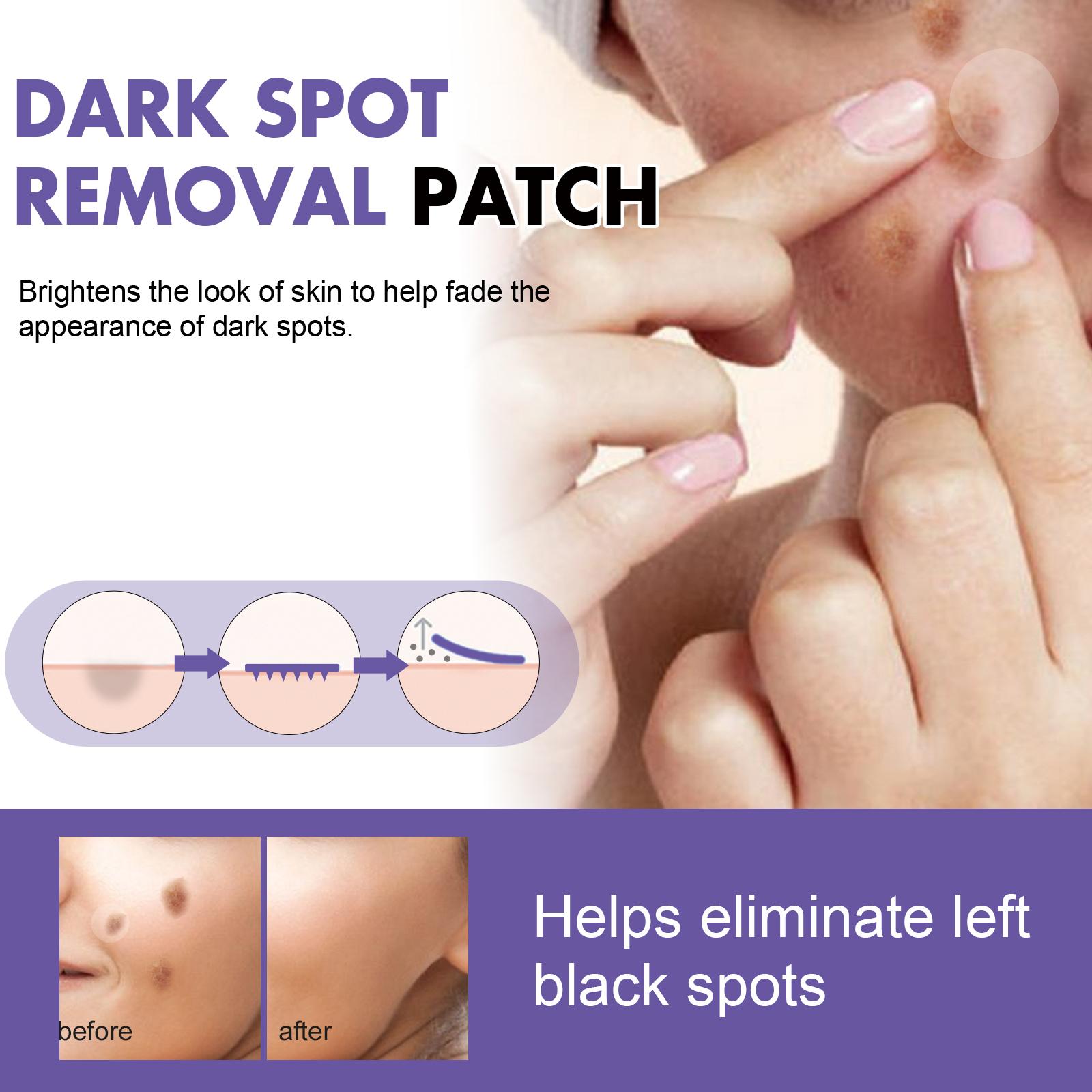 EELHOE Dark Spot Removal Patch, Lightening Face Dark Spots Melasma Spots Melanin Moisturizing Whitening Skin Spot Patch