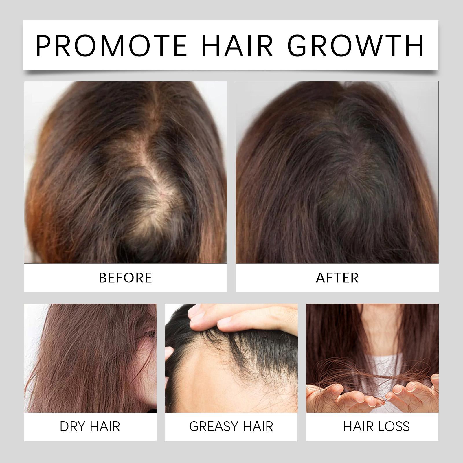 Hoegoa Hair Care Cap Volumizing Hair Nourishing Gentle Maintenance Smooth Shiny Hair Care Cap