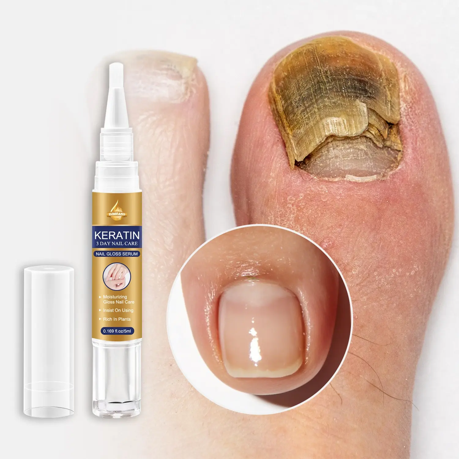 SUMIFANG Keratin 3-Day Gloss Nail Serum (5ml) – Keratin + Aloe Vera + Mint – Deeply moisturizes and nourishes the nail surface; provides 24-hour glossy protection; prevents breakage and peeling; keratin repairs and smooths the nail surface.