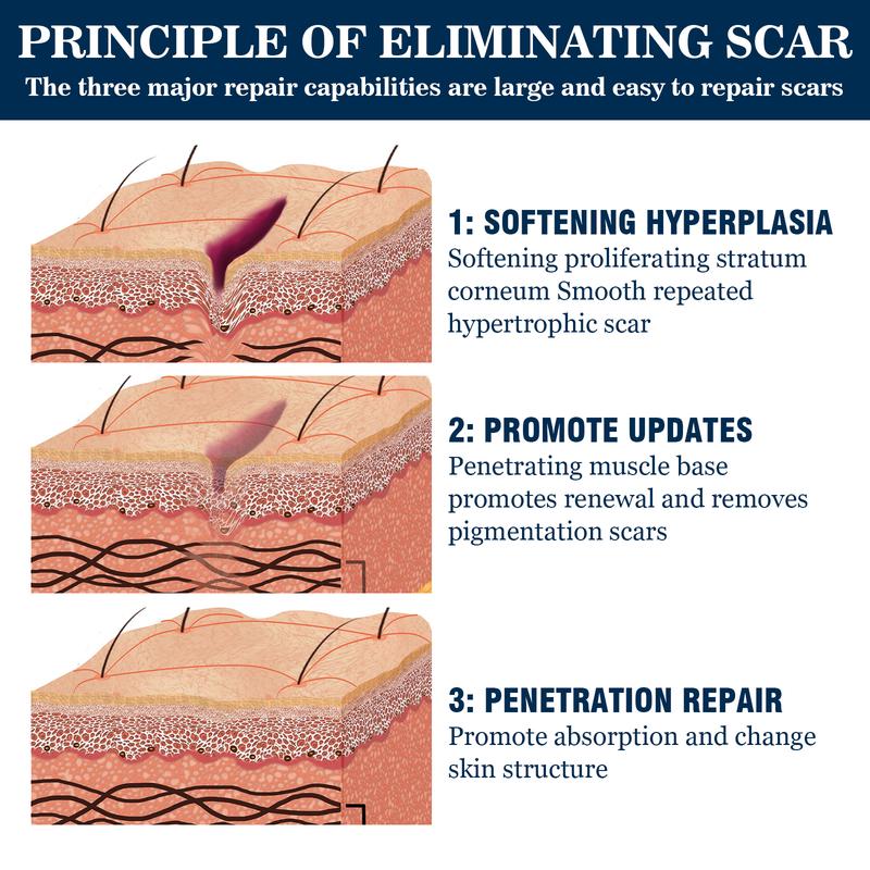 West&Month High-Grade Formula Scar Gel, Scar Repair Surgery Scar Pregnancy Smoothing Skin Care Gel