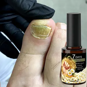 7 Days Strengthening Nail Care Oil with Vitamin E & Keratin for Soft Peeling Nails，Suitable for all nail types, perfect for holiday gifts