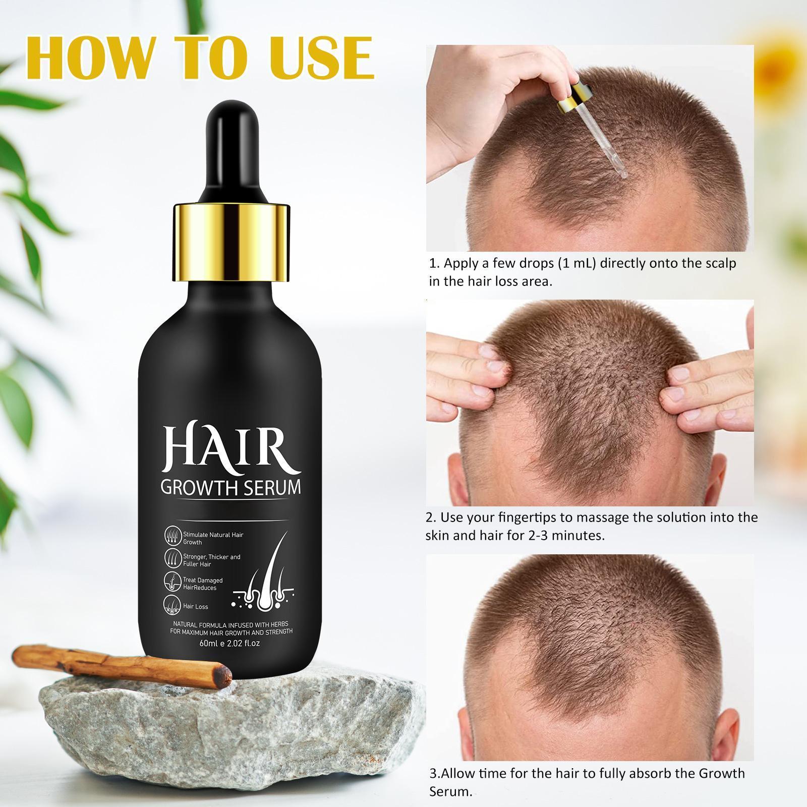 Hair Growth Oil for Men and Women - Regrowth Serum, Extra Strength Spray for Hair Loss, Thicker Healthier Hair, Beard Growth Kit, Topical Treatment, 2.02 oz