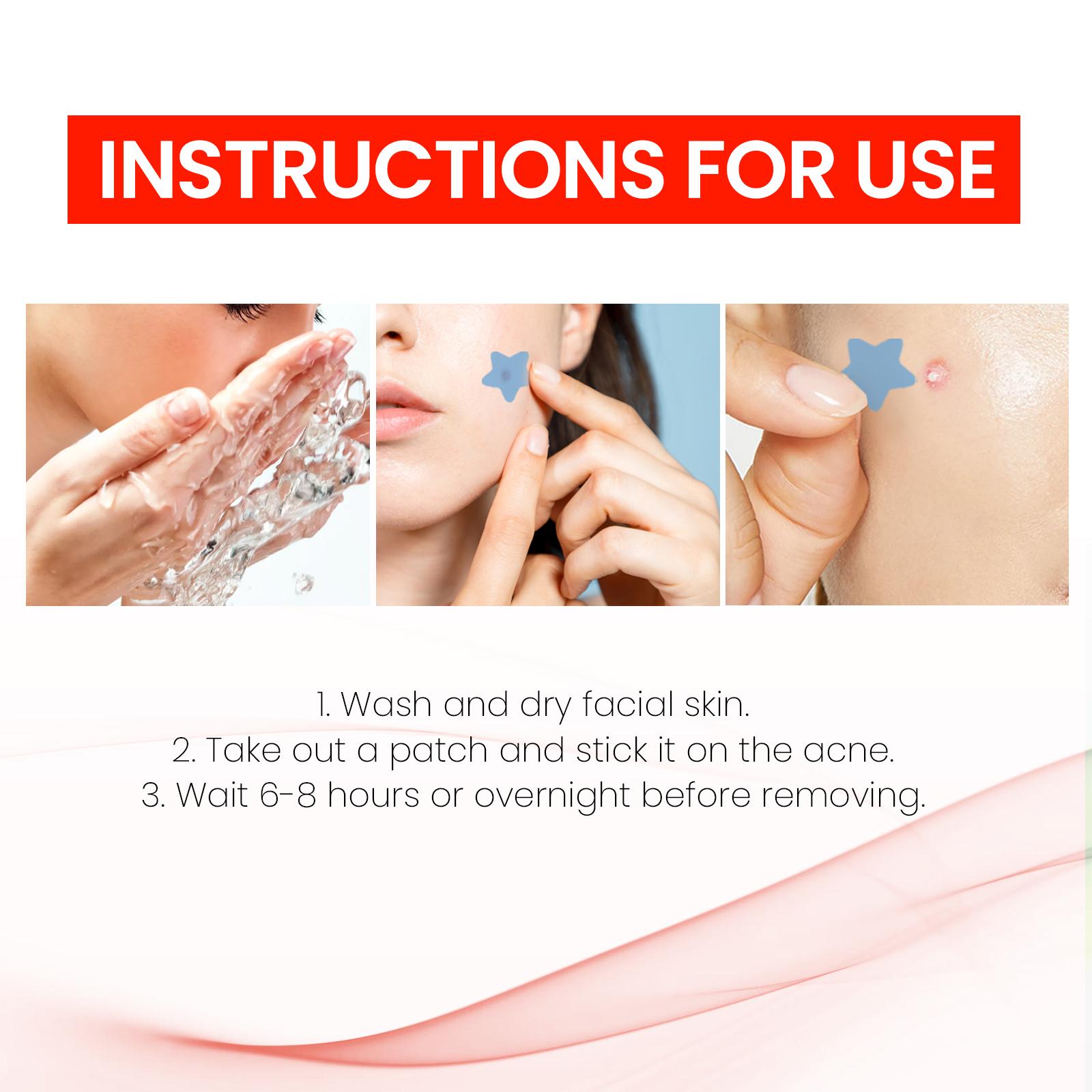 Jaysuing Gentle Acne Pore Cleansing Cover Patches 200pcs Colorful Hydrocolloid Stickers with Tea Tree and Witch Hazel for Blemish Care and Oil Control