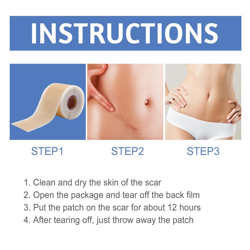 South Moon High Quality Silicone Scar Sheets, Fade Scar Waterproof Breathable Skin Scar Beauty Patch