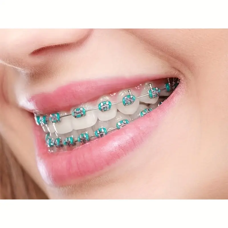 2025 Colorful Temporary Teeth Decorations | Cosplay Braces | Black Friday  Sale TikTok Shop