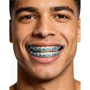 1 Pair Fashion Braces Colorful Temporary Tooth Decoration with Metal Wires Metal Bracket Orthodontic Ligature Ties High Quality smart ring