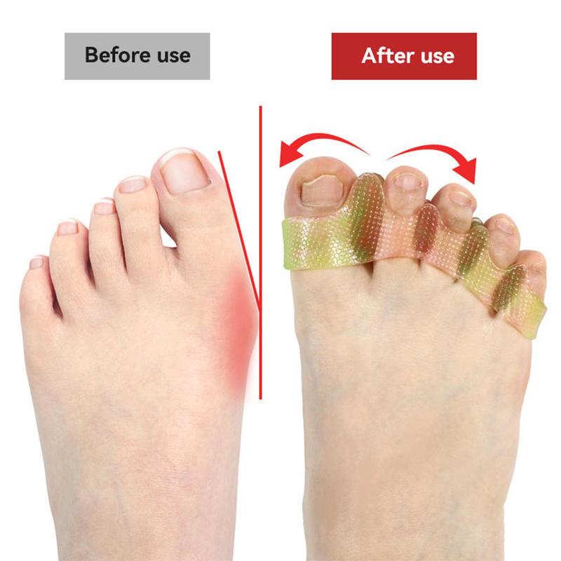 Toe Separators/Toe Spacers - For Men and Women - Correcting Bunions and Restoring Toes to Their Original Shape Suitable for Barefoot and Minimalists