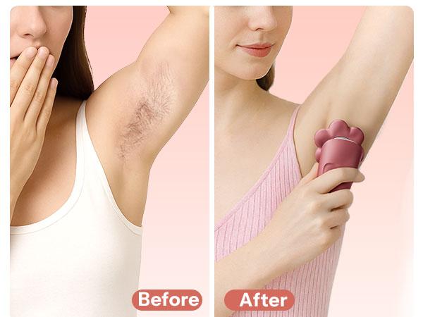 HiBig 7D Electric Legs & Body Shaver for Women - 5-in-1 Lady Grooming Kit for Bald Head, Legs & Armpits, Waterproof Rechargeable Painless Razor, Cordless Shaver with Floating Heads, Ideal Gift for Her