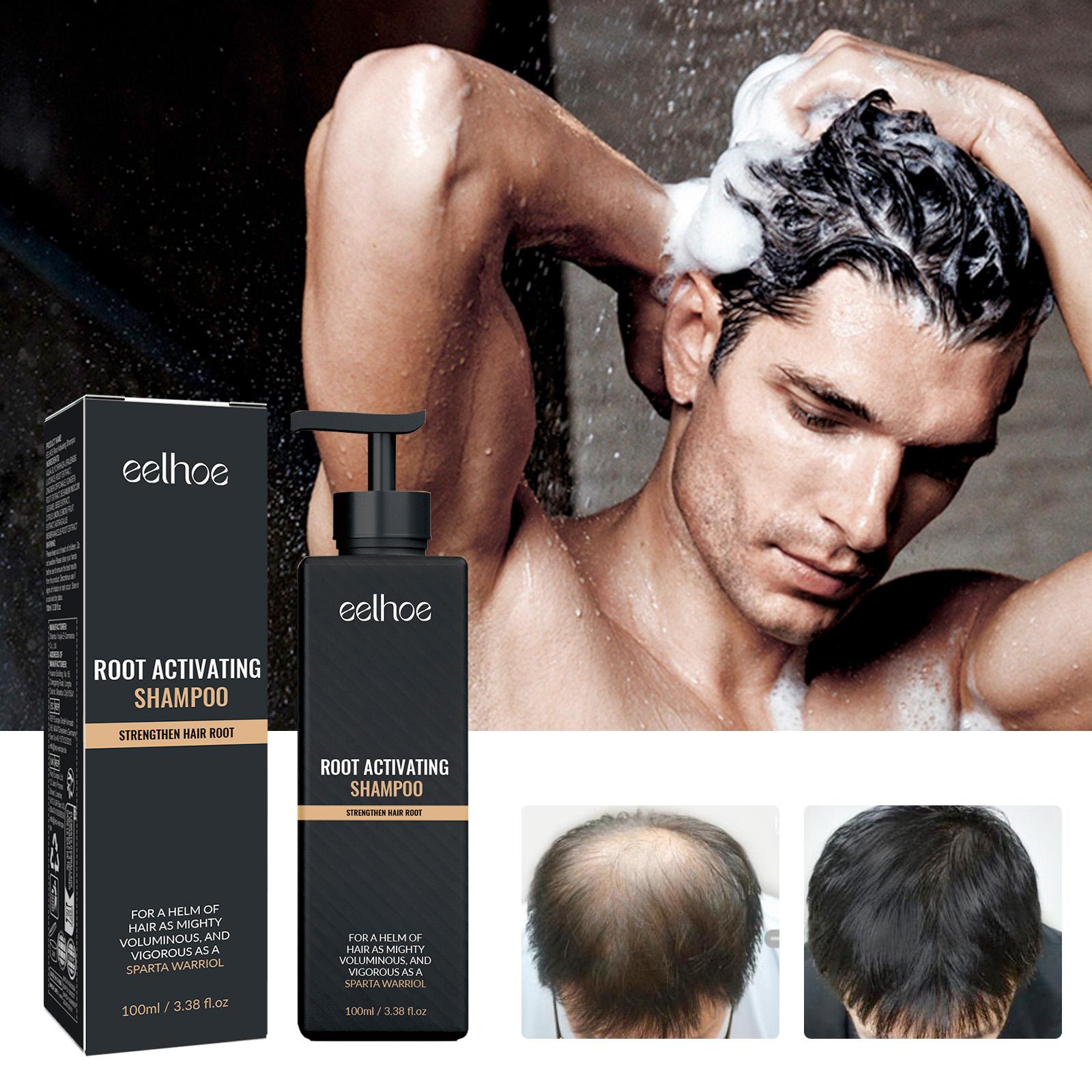 Eelhoe Root Activating Shampoo for Hair Growth and Regeneration - 100ml