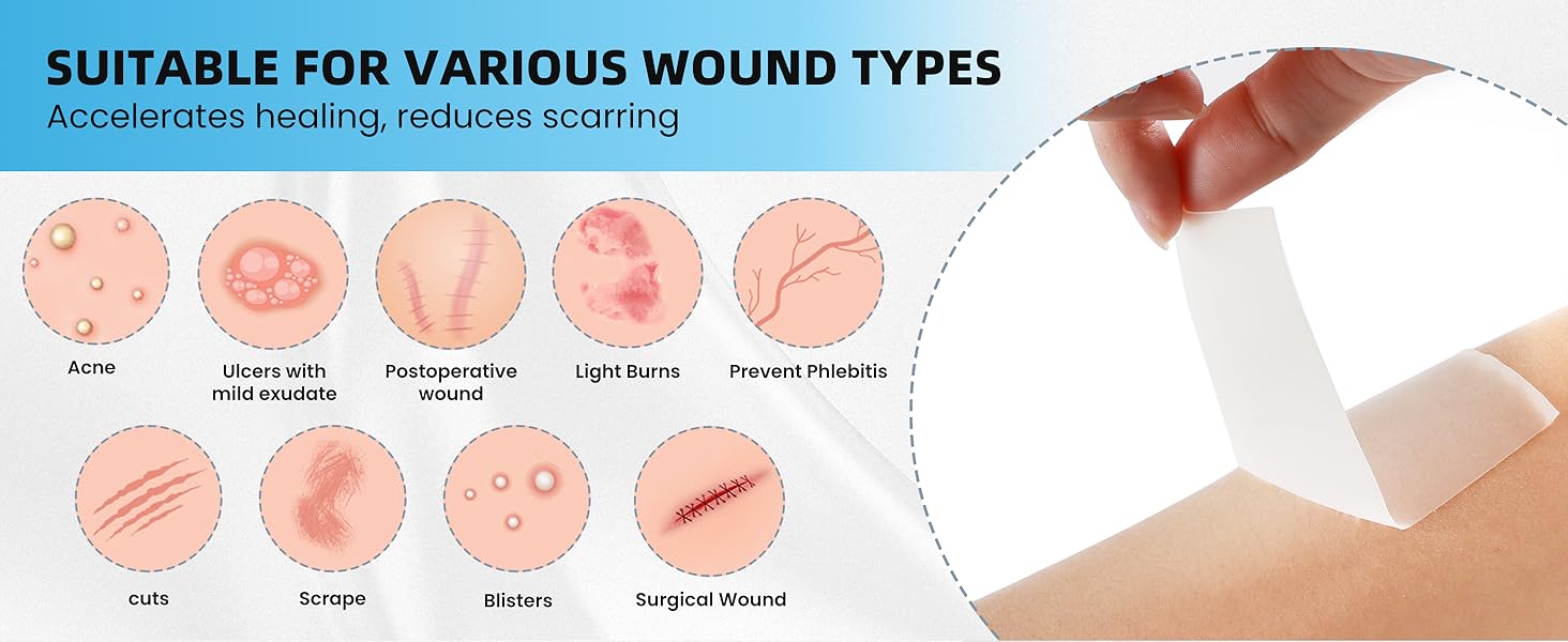 Hydrocolloid Roll Bandages, 2IN x 16FT Extra Large Hydrocolloid Patch with Self-Adhesive, Ultra Absorbent, Cut-to-Size, Flexible & Waterproof for Burn, Blister, Acne Care