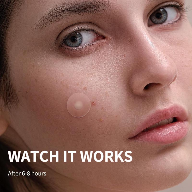 Pink White Hydrocolloid Acne Patches, 1 Set Blemishes Pimples Covering Patch Invisible Acne Patches, Pimple Patches, Blemish Relief Care Acne Clearing Products