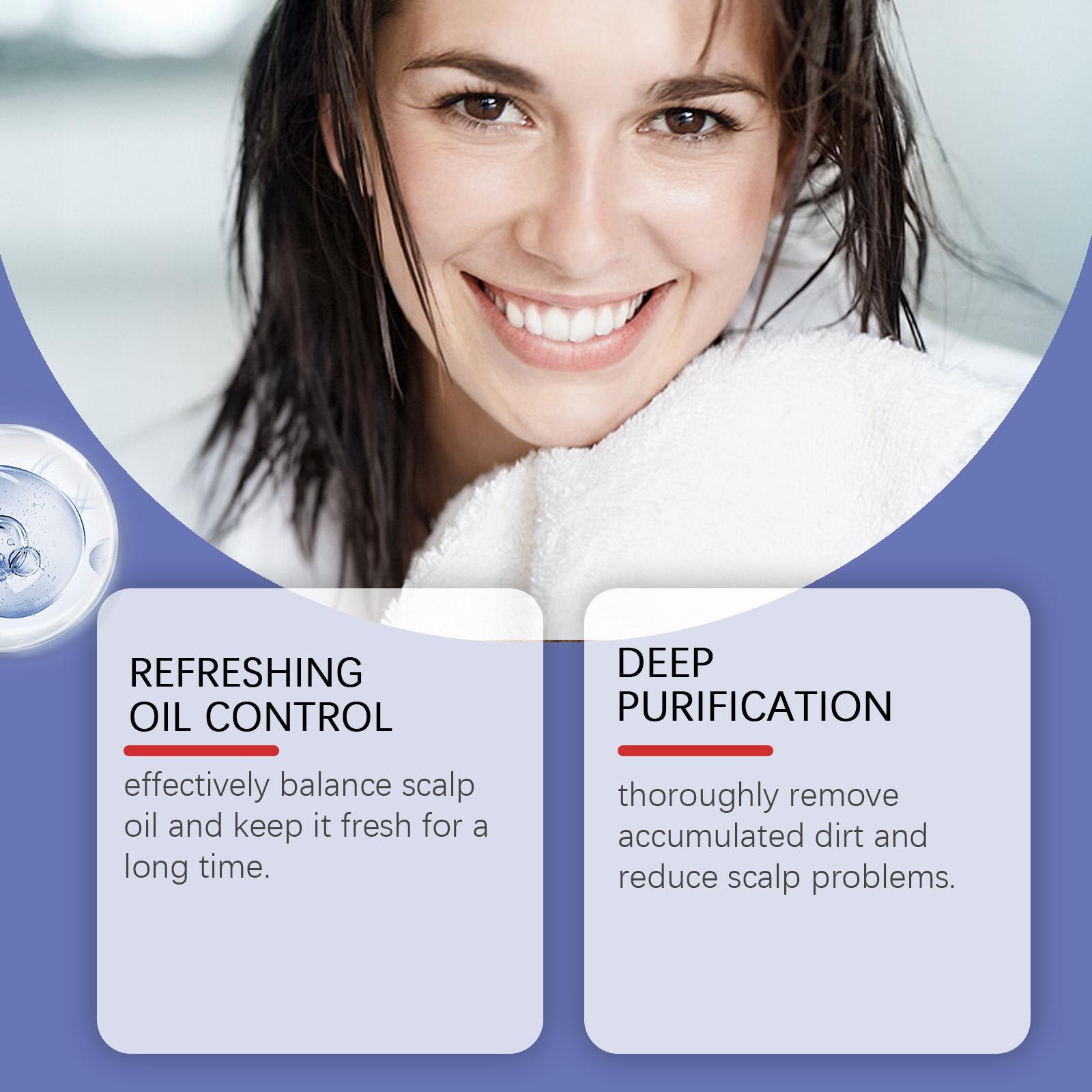 120ML X 2 Bundle Pack Selenium Disulfide HOEGOA Hair Care Shampoo: Anti-Dandruff Anti-Itch Oil Control Refreshing Scalp Cleanser Shampoo, Gentle Comfort Cleansing Conditioner Haircare 2 Bottle Bundle