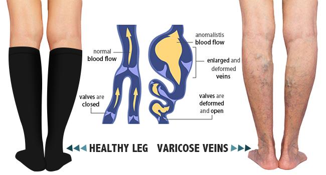 Compression Socks for Women and Men Circulation (3/4 Pairs) is Best Support for Running Athletic Cycling Hiking