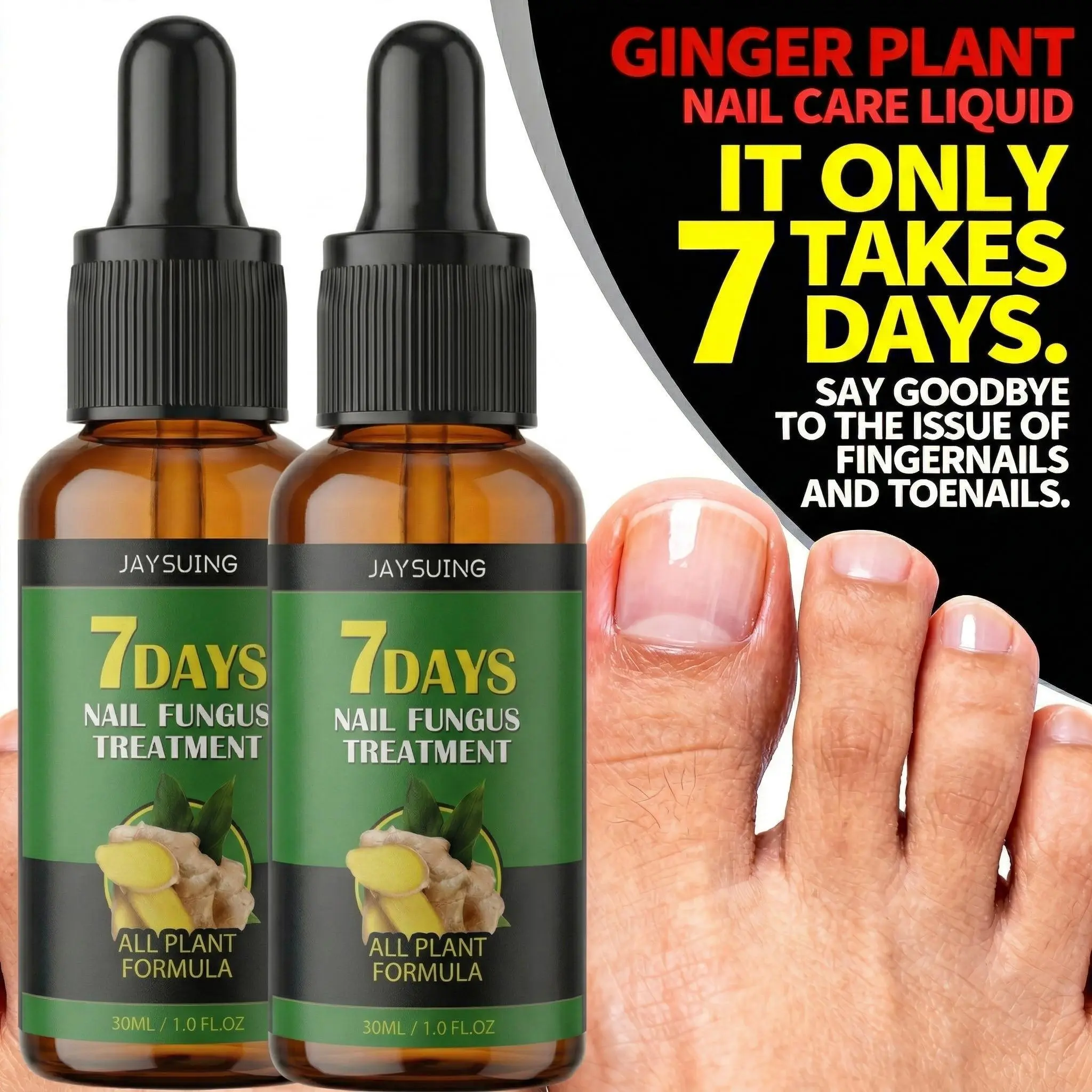 7 Days Ginger Nail Treatment Serum 30mL, Plant Based At Home Nail Repair Drops for Discolored Brittle Cracked Toenails, Cuticle Nourishing Conditioning Oil & Nail Restoration Support