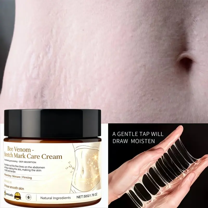 Postpartum Stretch Mark Cream – Bee Venom with Avocado Oil, Improve Skin Elasticity & Firmness, Natural 24H Moisturizer, 50g